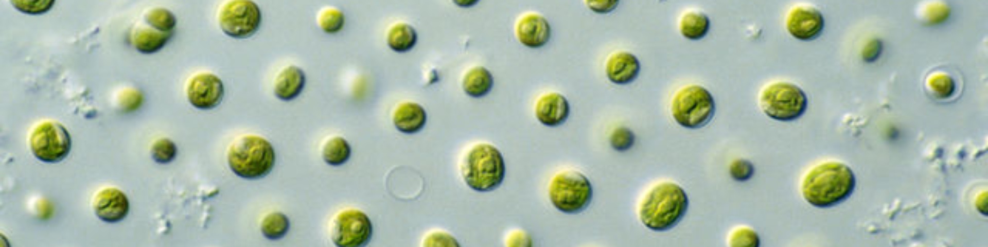 CSIRO_ScienceImage_10697_Microalgae CSIRO_ScienceImage_10697_Microalgae